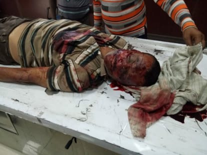 a car turtle in rs pura 3 killed